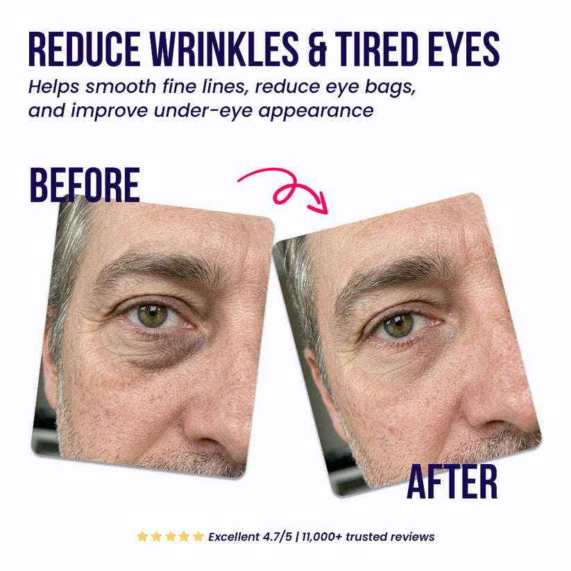 Tphflare-Eye Repair Patches for Men