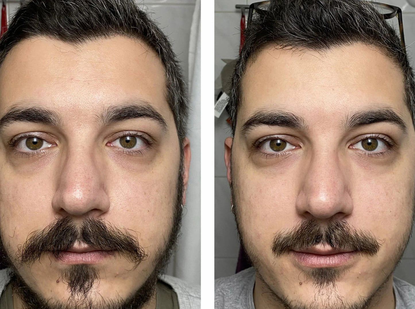 Tphflare-Eye Repair Patches for Men